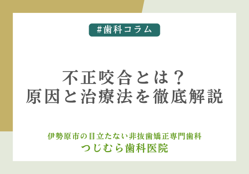 不正咬合とは？原因と治療法を徹底解説