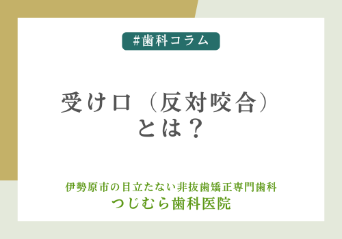 受け口（反対咬合）とは？