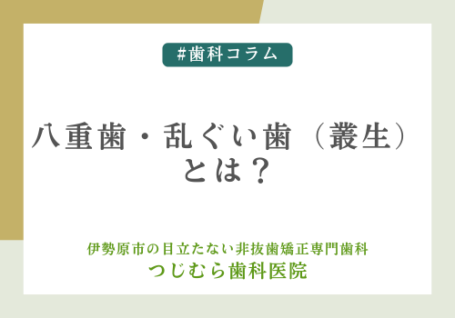 八重歯・乱ぐい歯 （叢生）とは？