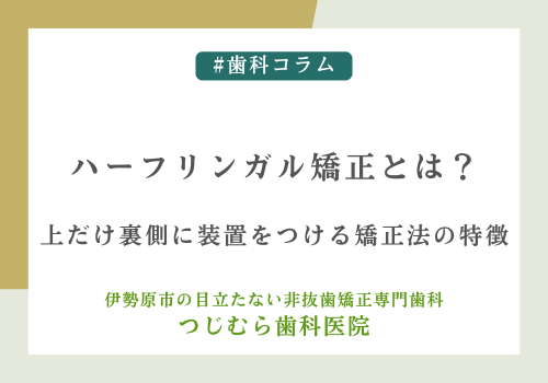 ハーフリンガル矯正とは？上だけ裏側に装置をつける矯正法の特徴
