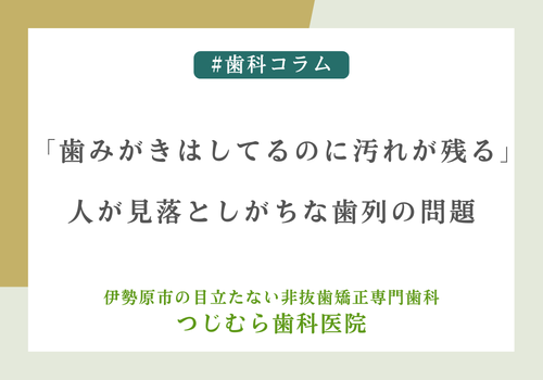 「歯みがきはしてるのに汚れが残る」人が見落としがちな歯列の問題