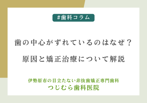 歯の中心がずれているのはなぜ？原因と矯正治療について解説