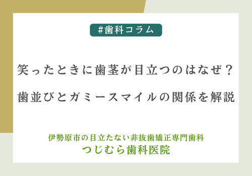 笑ったときに歯茎が目立つのはなぜ？歯並びとガミースマイルの関係を解説