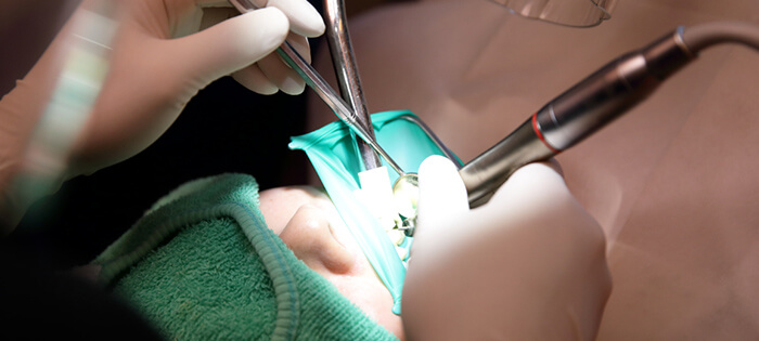 歯科治療の限界
