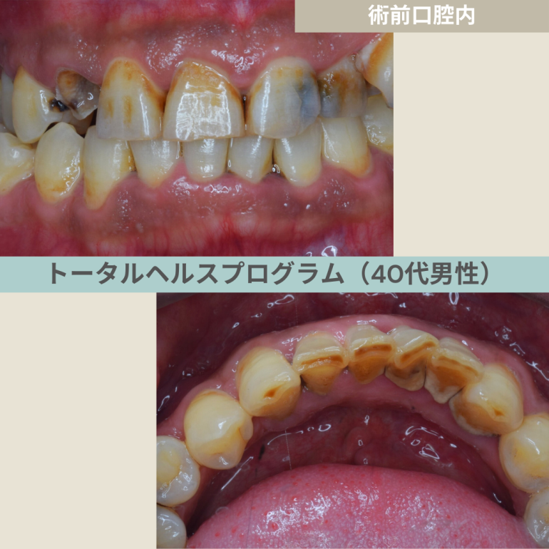 症例17-1