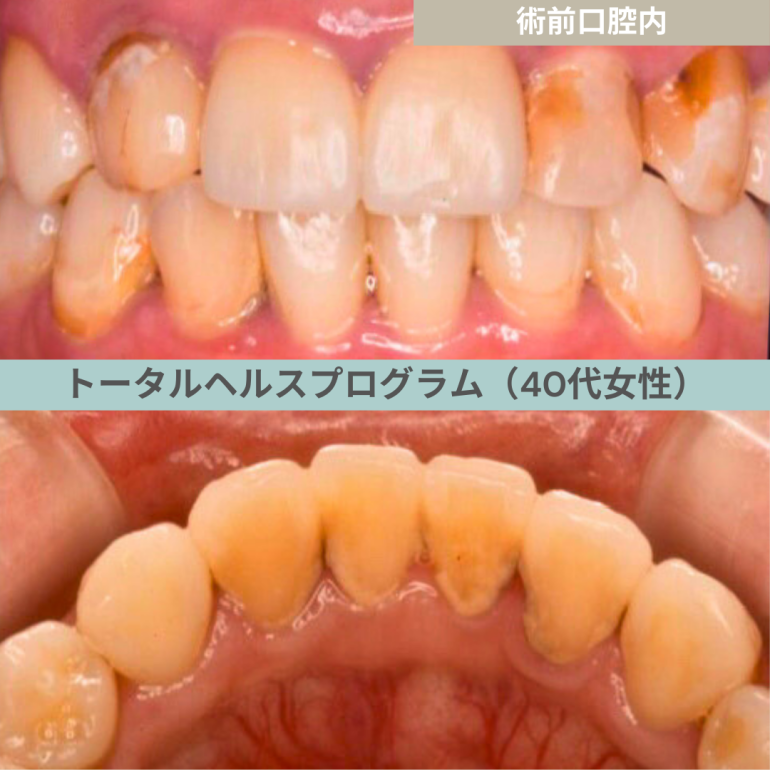 【症例２２−１】THP_トータルヘルスプログラム｜40代女性