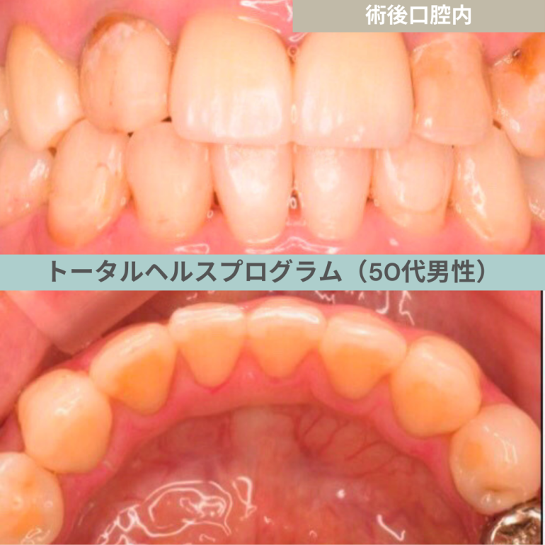 【症例２２−２】THP_トータルヘルスプログラム｜40代女性