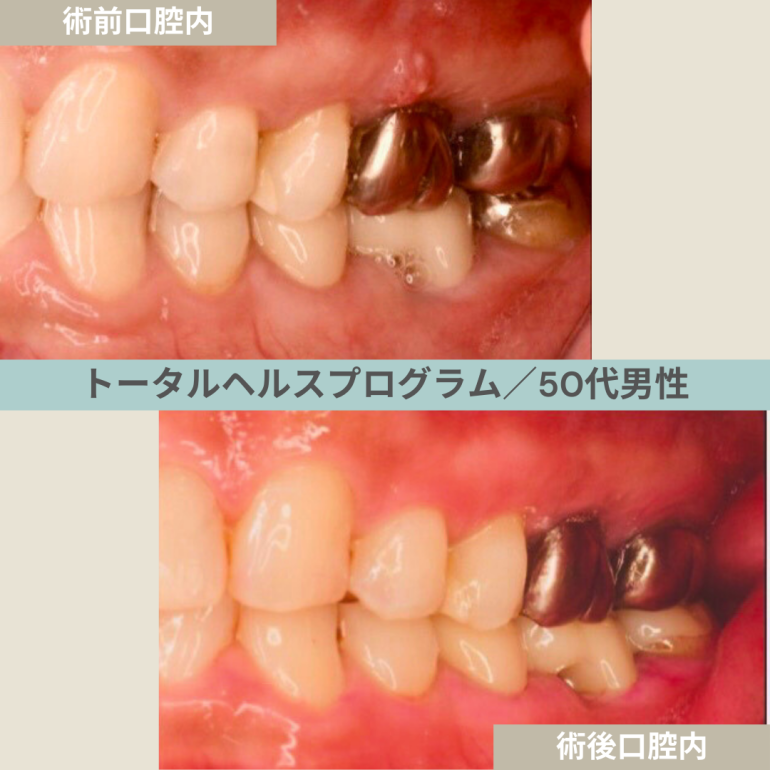 【症例２４】THP_トータルヘルスプログラム｜50代男性