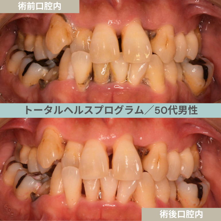 【症例２５】THP_トータルヘルスプログラム｜50代男性