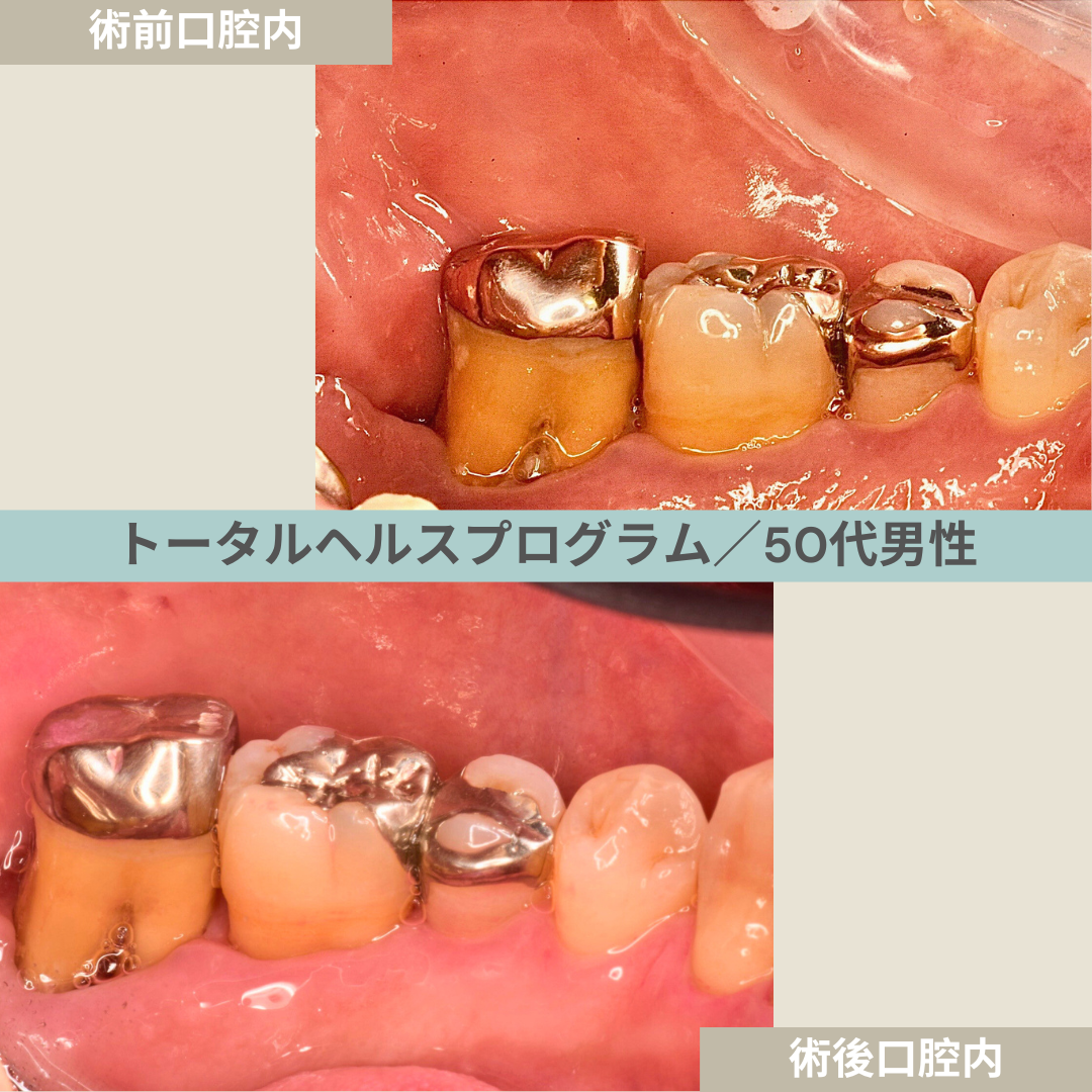 【症例２９】THP_トータルヘルスプログラム｜50代男性