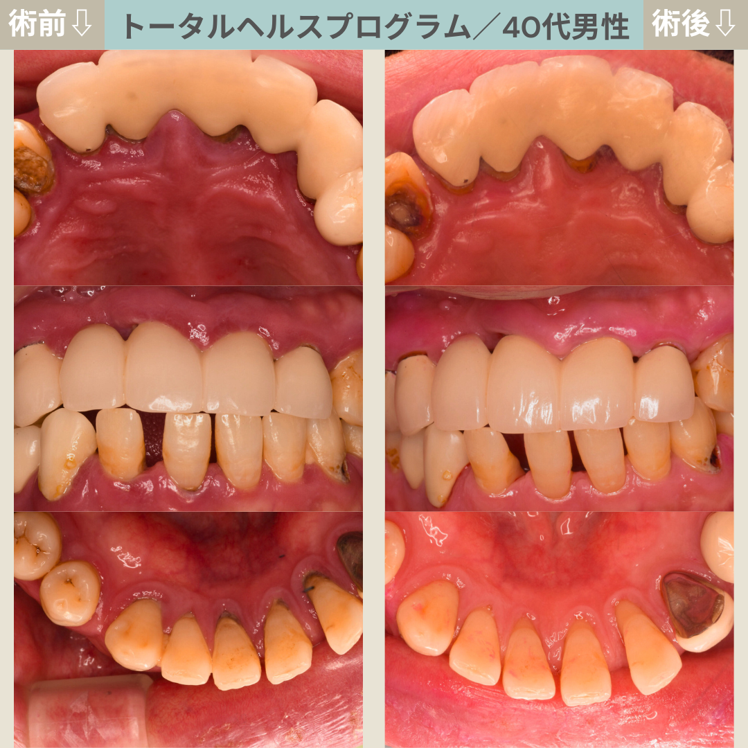 【症例３２】THP_トータルヘルスプログラム｜40代男性