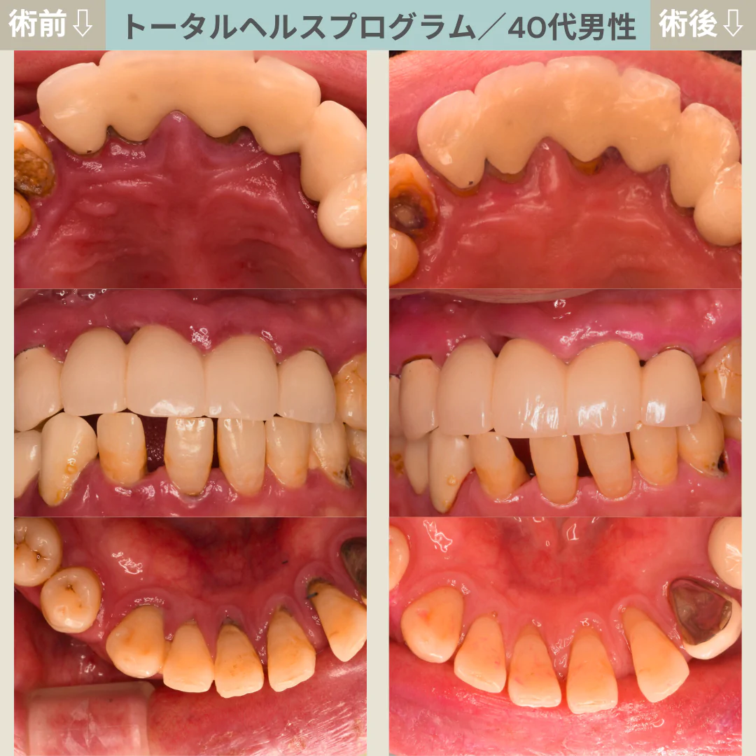 【症例３２】THP_トータルヘルスプログラム｜40代男性