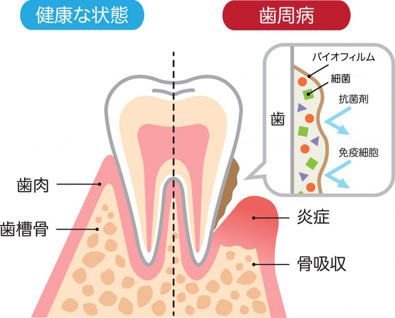 再発率0％を追求した歯周病治療専門THP(トータルヘルスプログラム)つじむら歯科医院(神奈川県伊勢原市の歯医者・歯科)